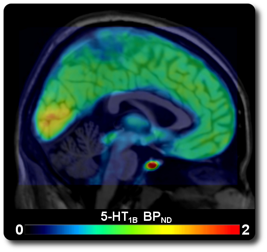 Serotonin-1B Receptor Distribution Map